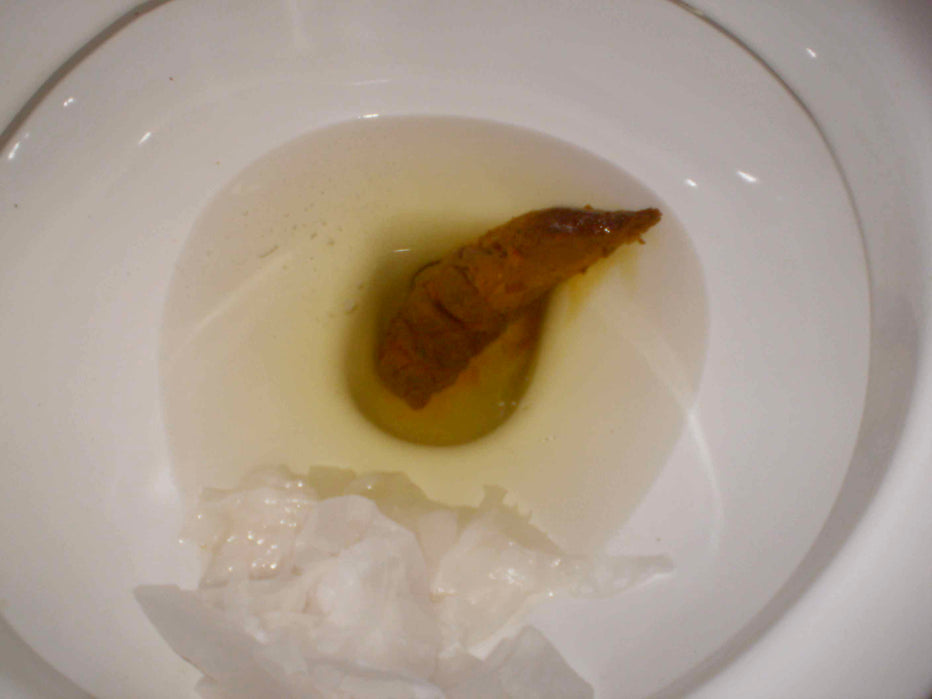 TORONTO.......... not shit......